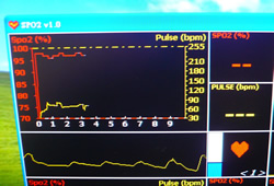 perfusion index poor